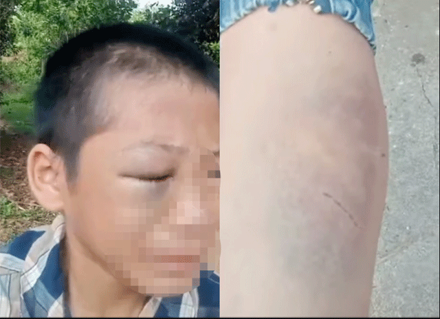 Xót xa cảnh cậu bé học lớp 6 hoảng sợ, liên tục khóc sau khi bị mẹ kế đánh đến mức không mở nổi mắt