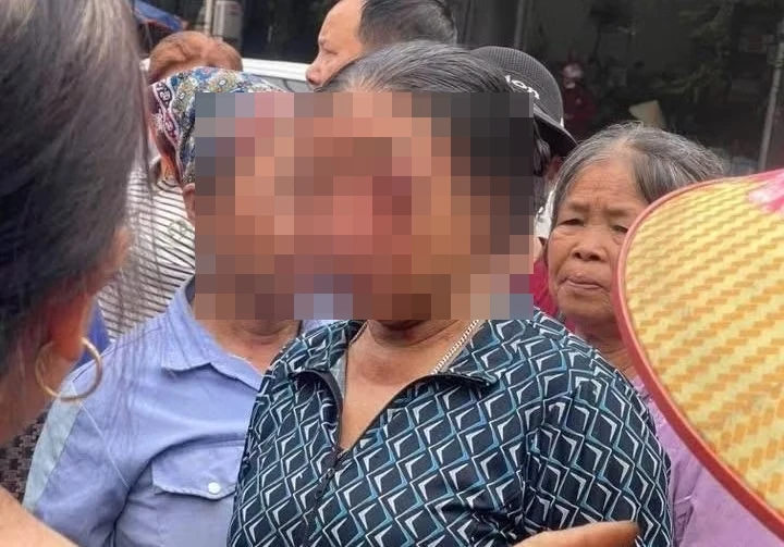 Vụ người phụ nữ bán rau bị x,ịt nước vào mắt: Hiện cơ thể suy kiệt, phải khâu 5 mũi và hiện vẫn chưa thể mở mắt